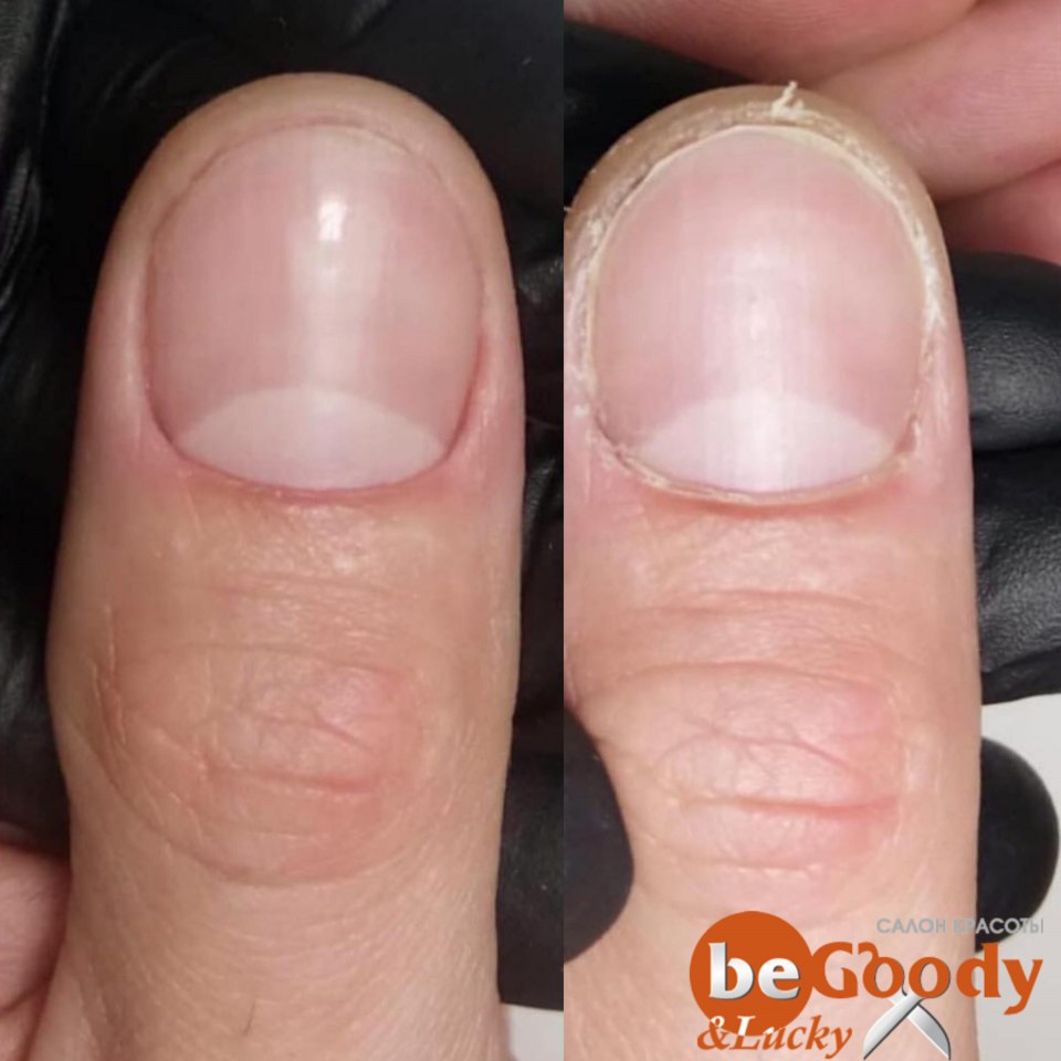 Мужская ногтевая пластина