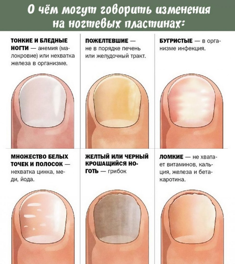 Ногтевая пластина в разрезе