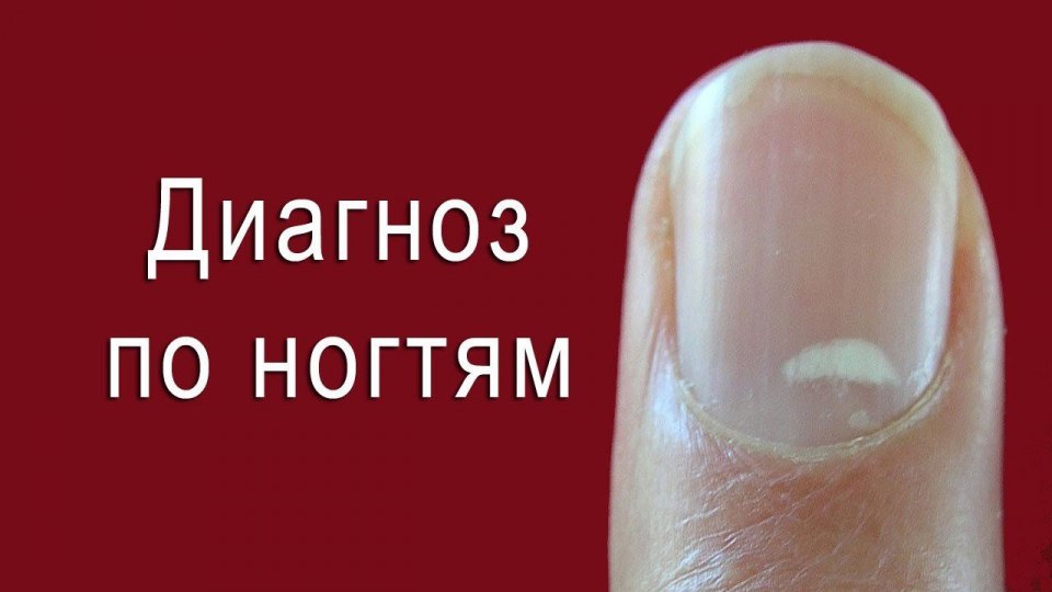 Диагностика по ногтям
