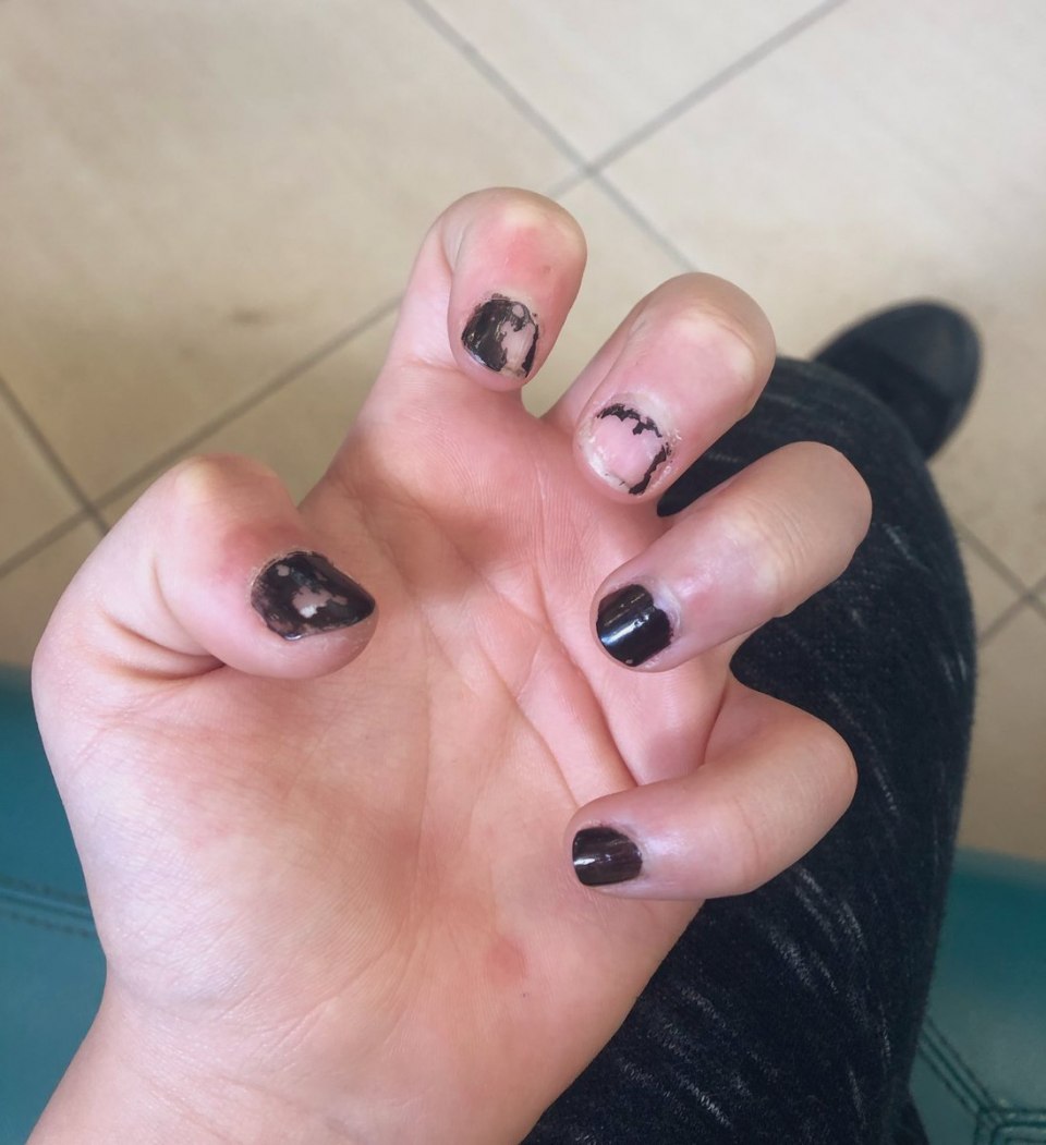 Короткие ногти обкусанные