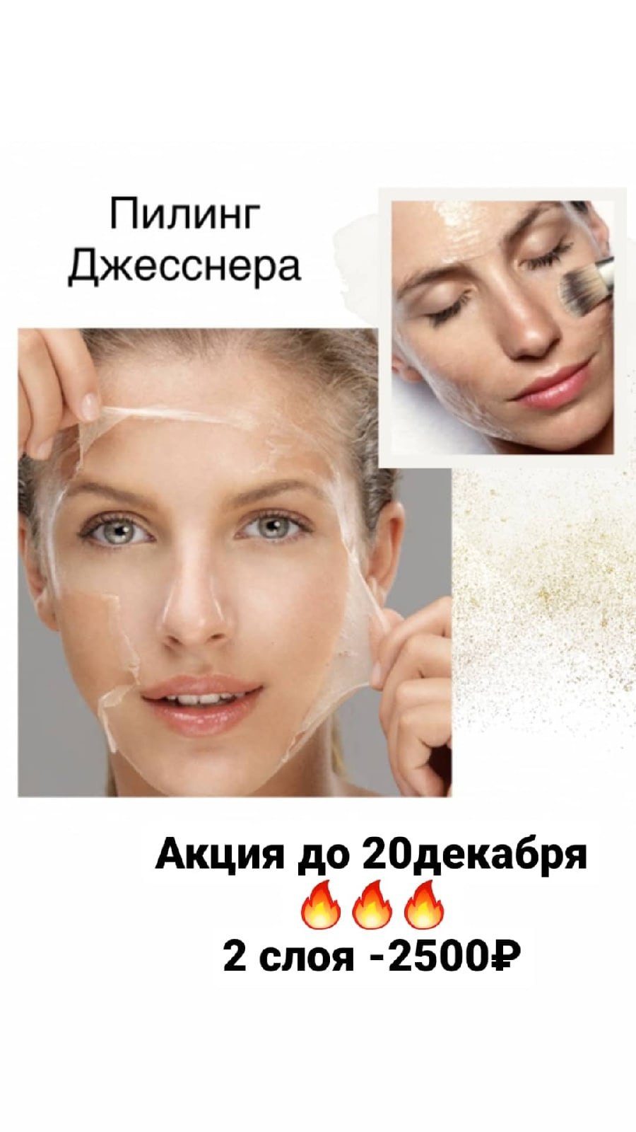Голливудский пилинг Джесснера
