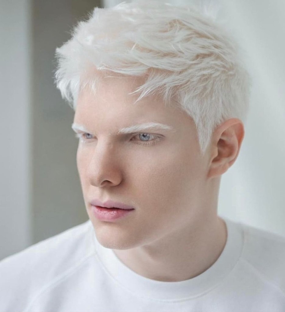 Девушка-альбинос, бывшая в московской школе изгоем, покорила мир моды