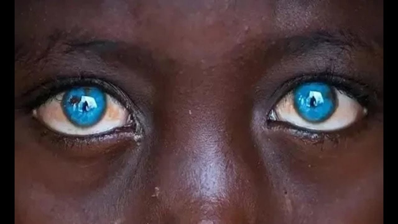 Почему глаза-хамелеоны меняют цвет?
