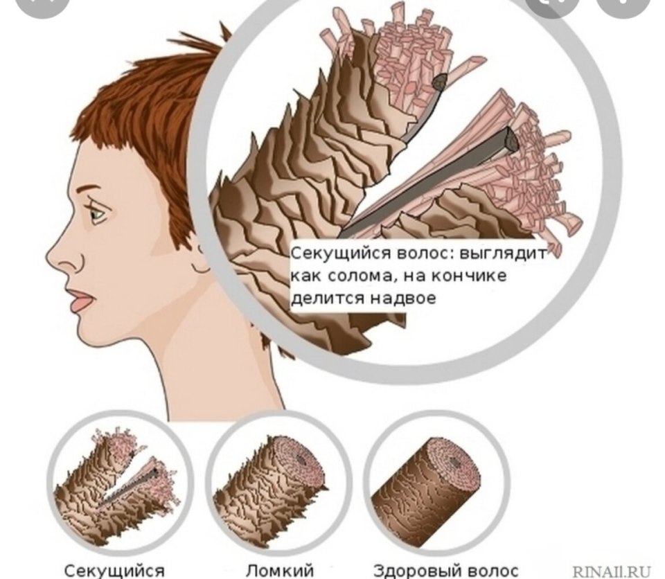 Секущиеся волосы