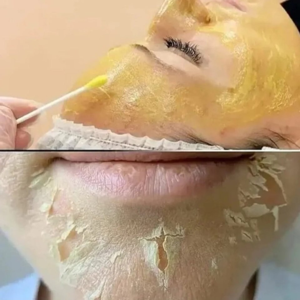 Пилинг Yellow Peel жёлтый ретиноловый