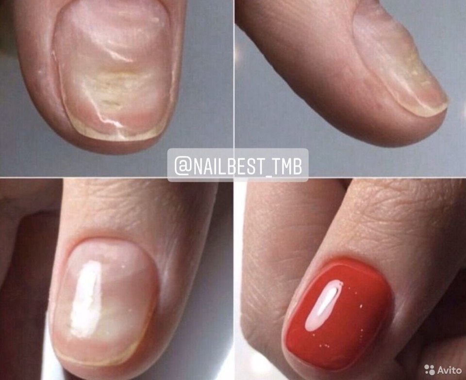 Укрепление гель лаком