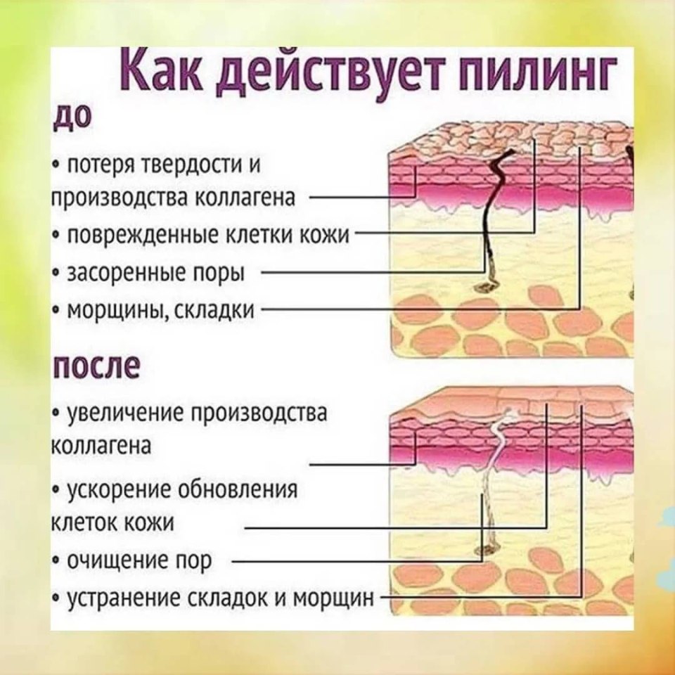 Воздействие пилинга на слои кожи