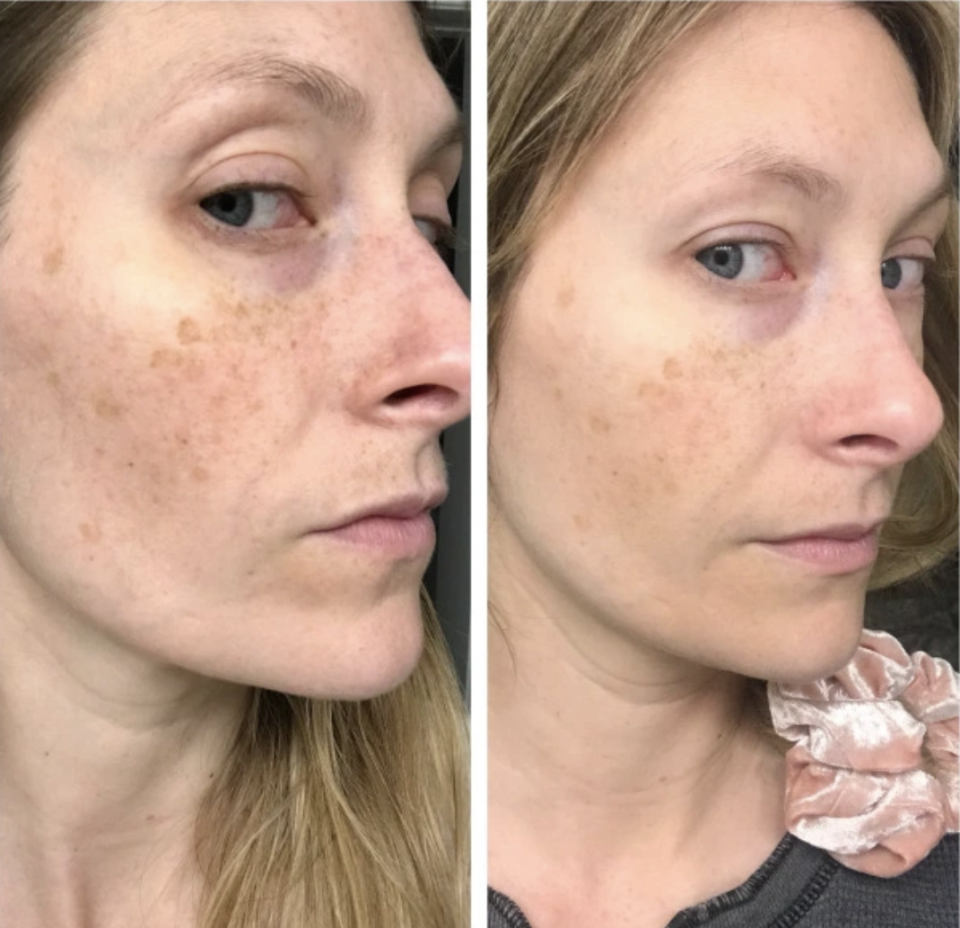 Сыворотка для кожи лица the ordinary Alpha Arbutin 2% + ha