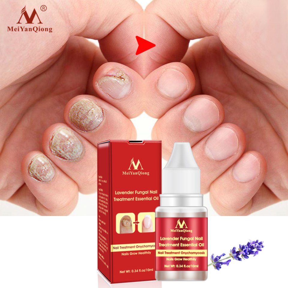 MEIYANQIONG Lavender fungal Nail