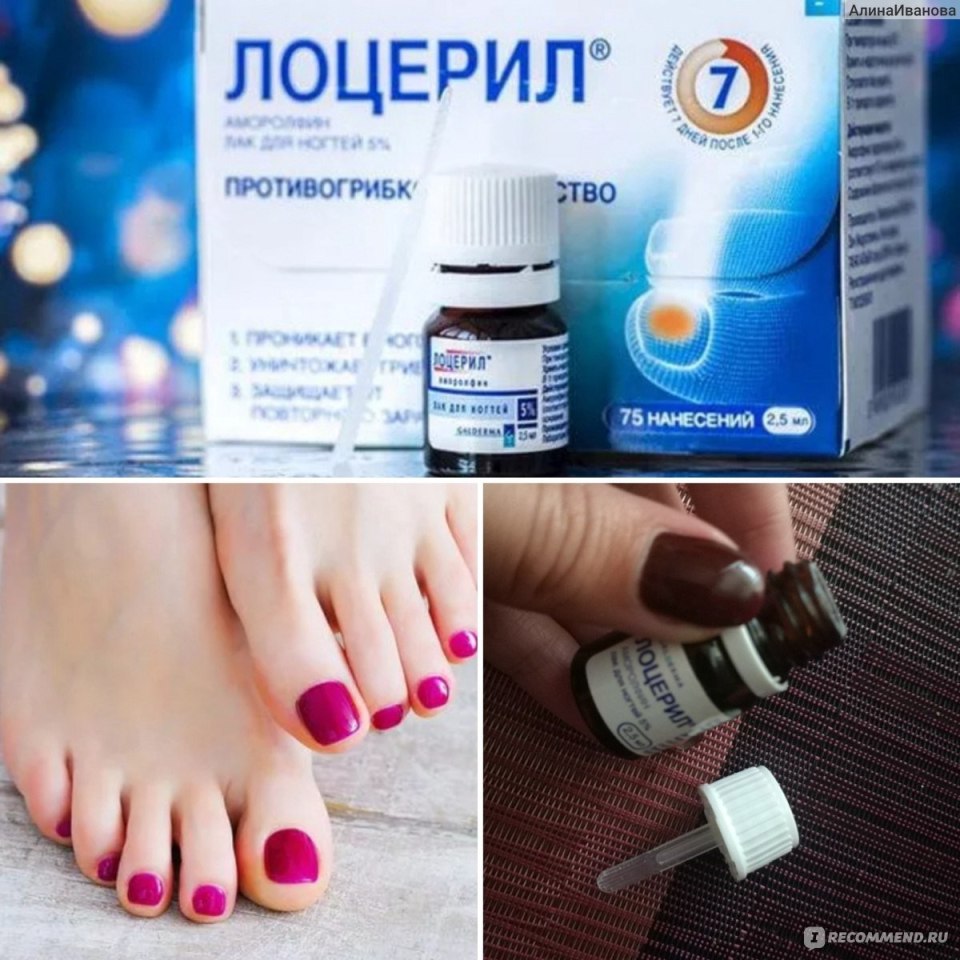 Лоцерил лак от грибка
