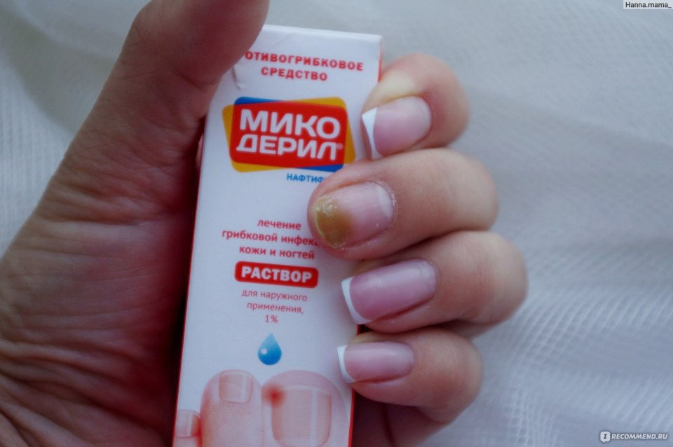 Средство от грибка ногтей на руках