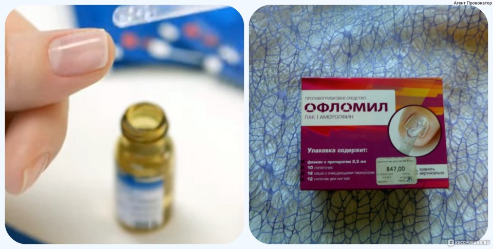 Офломил лак от грибка ногтей