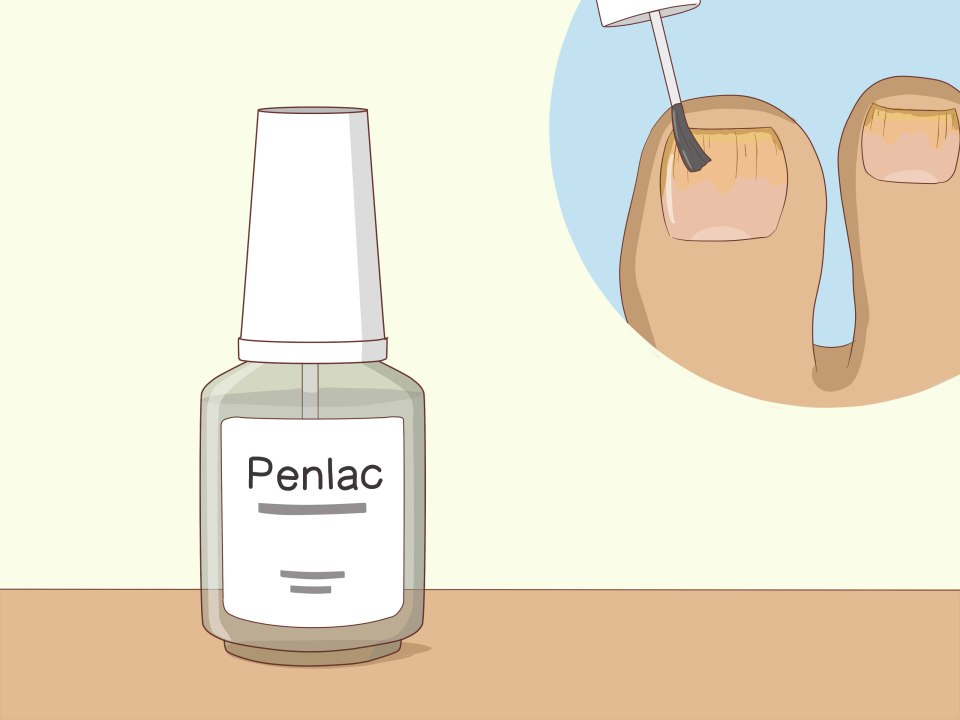 Лак для ногтей от грибка fungal Nail