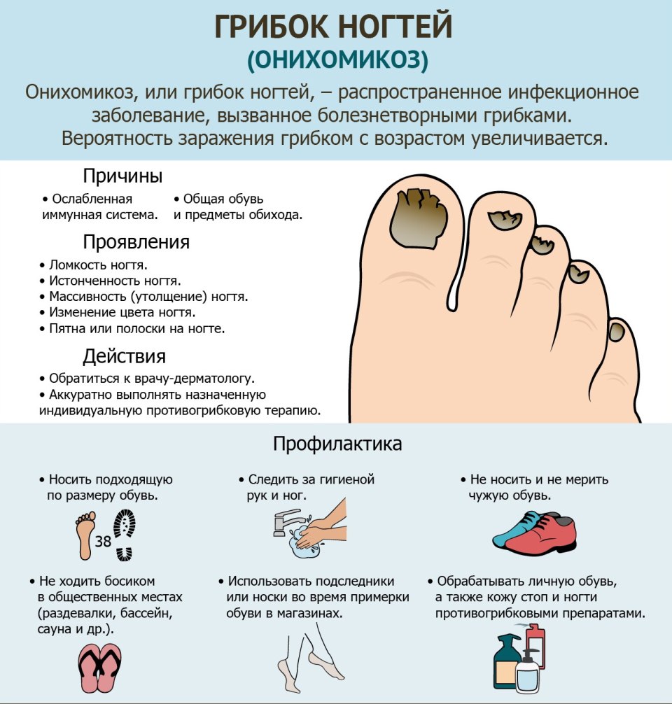 Грибковое поражение ногтей на ногах
